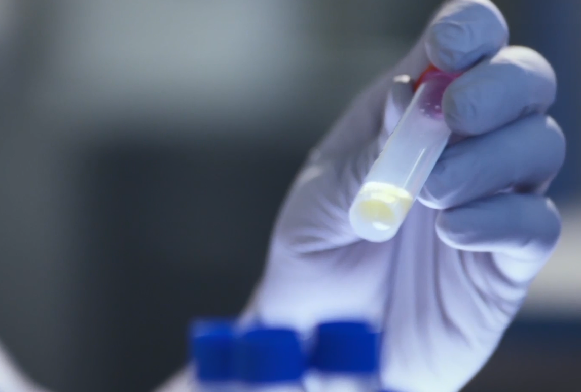 病毒中和抗體檢測